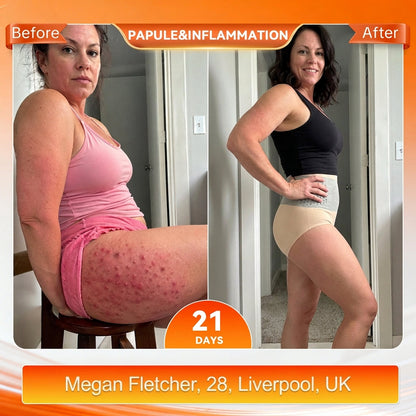 UK 𝐎𝐟𝐟𝐢𝐜𝐢𝐚𝐥 𝐁𝐫𝐚𝐧𝐝 𝐒𝐭𝐨𝐫𝐞 💎 𝑨𝑳𝑳𝒀𝑩𝑬𝑬® 𝟐𝟎𝟐𝟔 𝐌𝐨𝐫𝐢𝐧𝐠𝐚 & 𝐁𝐞𝐫𝐛𝐞𝐫𝐢𝐧𝐞 𝟒-𝐈𝐧-𝟏 𝐌𝐢𝐜𝐫𝐨-𝐏𝐚𝐫𝐭𝐢𝐜𝐥𝐞 𝐒𝐜𝐮𝐥𝐩𝐭𝐢𝐧𝐠 & 𝐅𝐚𝐭-𝐁𝐮𝐫𝐧 𝐒𝐡𝐨𝐫𝐭𝐬