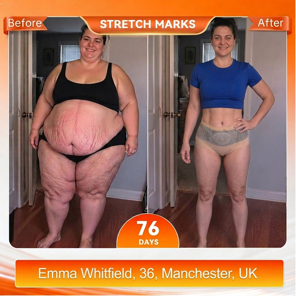 UK 𝐎𝐟𝐟𝐢𝐜𝐢𝐚𝐥 𝐁𝐫𝐚𝐧𝐝 𝐒𝐭𝐨𝐫𝐞 💎 𝑨𝑳𝑳𝒀𝑩𝑬𝑬® 𝟐𝟎𝟐𝟔 𝐌𝐨𝐫𝐢𝐧𝐠𝐚 & 𝐁𝐞𝐫𝐛𝐞𝐫𝐢𝐧𝐞 𝟒-𝐈𝐧-𝟏 𝐌𝐢𝐜𝐫𝐨-𝐏𝐚𝐫𝐭𝐢𝐜𝐥𝐞 𝐒𝐜𝐮𝐥𝐩𝐭𝐢𝐧𝐠 & 𝐅𝐚𝐭-𝐁𝐮𝐫𝐧 𝐒𝐡𝐨𝐫𝐭𝐬