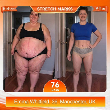UK 𝐎𝐟𝐟𝐢𝐜𝐢𝐚𝐥 𝐁𝐫𝐚𝐧𝐝 𝐒𝐭𝐨𝐫𝐞 💎 𝑨𝑳𝑳𝒀𝑩𝑬𝑬® 𝟐𝟎𝟐𝟔 𝐌𝐨𝐫𝐢𝐧𝐠𝐚 & 𝐁𝐞𝐫𝐛𝐞𝐫𝐢𝐧𝐞 𝟒-𝐈𝐧-𝟏 𝐌𝐢𝐜𝐫𝐨-𝐏𝐚𝐫𝐭𝐢𝐜𝐥𝐞 𝐒𝐜𝐮𝐥𝐩𝐭𝐢𝐧𝐠 & 𝐅𝐚𝐭-𝐁𝐮𝐫𝐧 𝐒𝐡𝐨𝐫𝐭𝐬